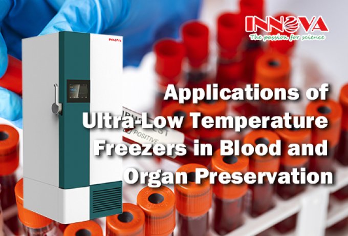 Application of Ultra-Low Temperature Freezers in Blood and Organ Preservation
